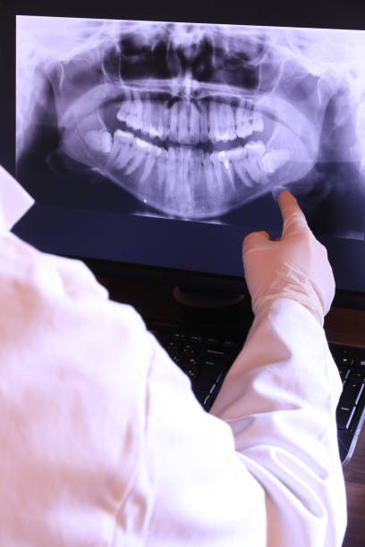 Best Knocked-Out Tooth (Avulsed Tooth) Treatment in Menands, NY